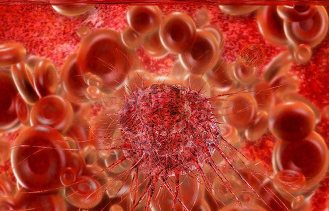 NGO  Screens 16,139 Persons For Cancer